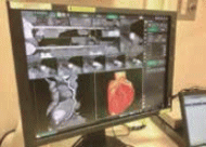 サーバー型ワークステーション